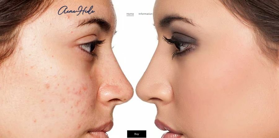 AcneHide — anti-acne gel and tablets